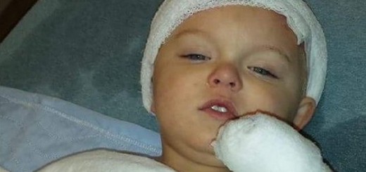 Toddler Scalded by 150 Degree Toilet Water
